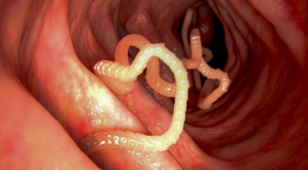diagnóstico de parasitas nos intestinos