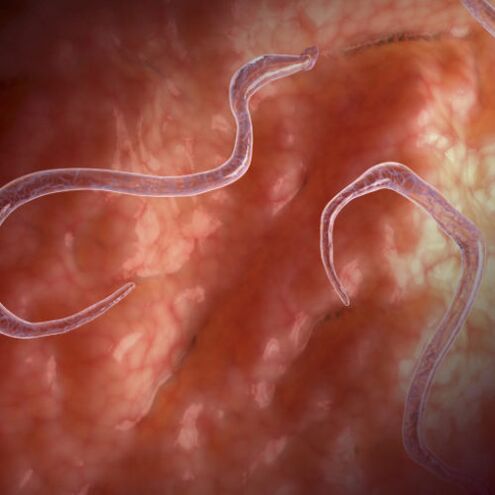 Parasitas no intestino