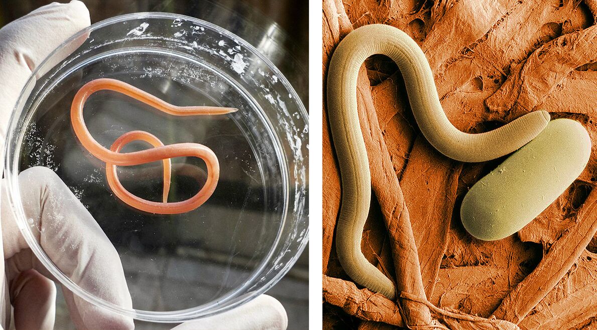 parasitas no corpo humano