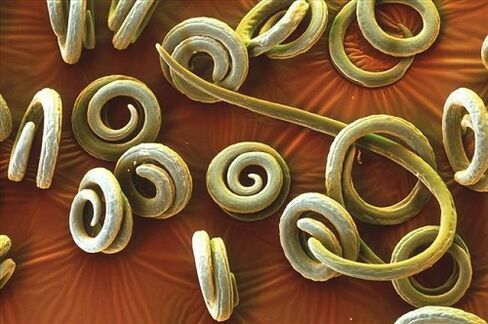 parasitas humanos priquinella