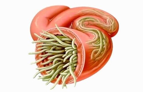 vermes são parasitas no intestino humano
