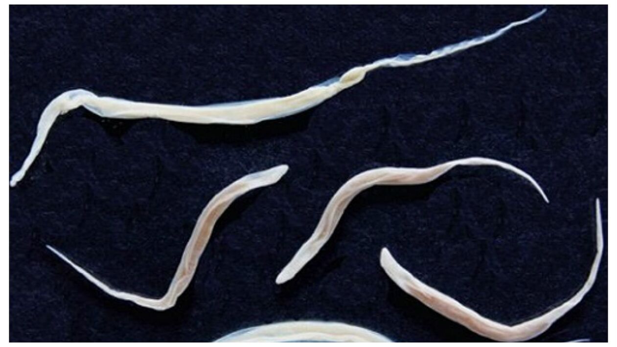 Pinworms são parasitas comuns pertencentes ao grupo dos helmintos.