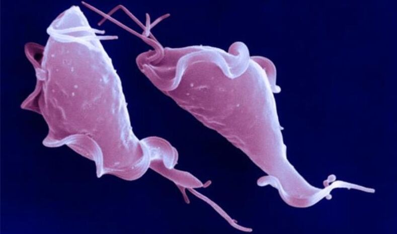 Trichomonas vaginalis é um parasita protozoário que causa infertilidade.